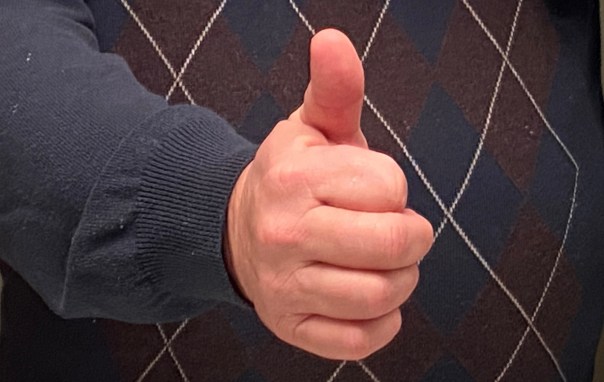 Thumbs up